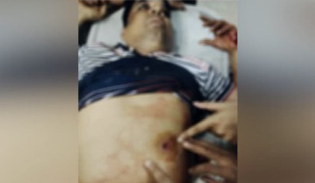 নোয়াখালীতে বিএনপি নেতাকে লক্ষ্য করে গুলি, সহযোগী গুরুতর আহত